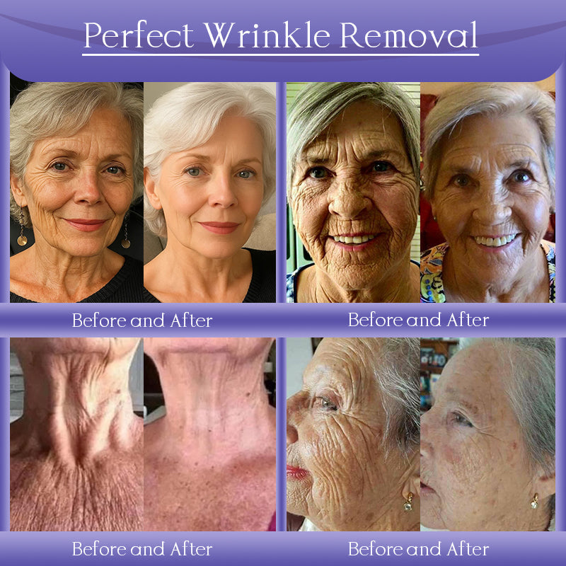 Jorondy® Anti-Wrinkle Skin Cream for Remove Wrinkles, Firms Skin, Whitening - Last Day Sale❤90% OFF