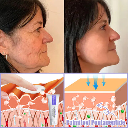 Jorondy® Anti-Wrinkle Skin Cream for Remove Wrinkles, Firms Skin, Whitening - Last Day Sale❤90% OFF