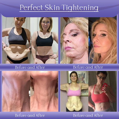 Jorondy® Anti-Wrinkle Skin Cream for Remove Wrinkles, Firms Skin, Whitening - Last Day Sale❤90% OFF