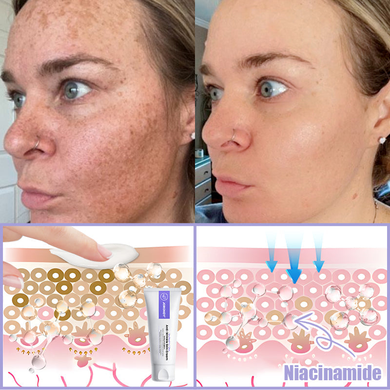 Jorondy® Anti-Wrinkle Skin Cream for Remove Wrinkles, Firms Skin, Whitening - Last Day Sale❤90% OFF