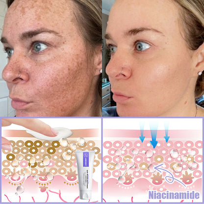Jorondy® Anti-Wrinkle Skin Cream for Remove Wrinkles, Firms Skin, Whitening - Last Day Sale❤90% OFF