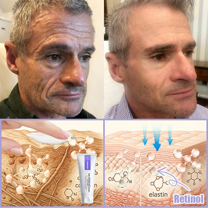 Jorondy® Anti-Wrinkle Skin Cream for Remove Wrinkles, Firms Skin, Whitening - Last Day Sale❤90% OFF